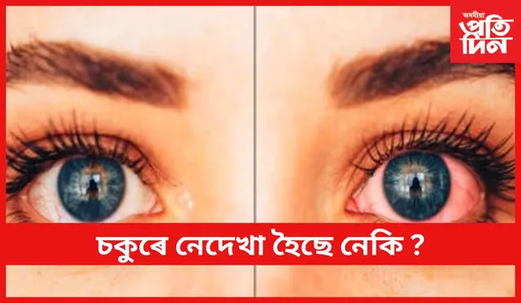 চকুৰ উন্নত স্বাস্থ্যৰ বাবে ঘৰতে অৱলম্বন কৰক এইসমূহ উপায়